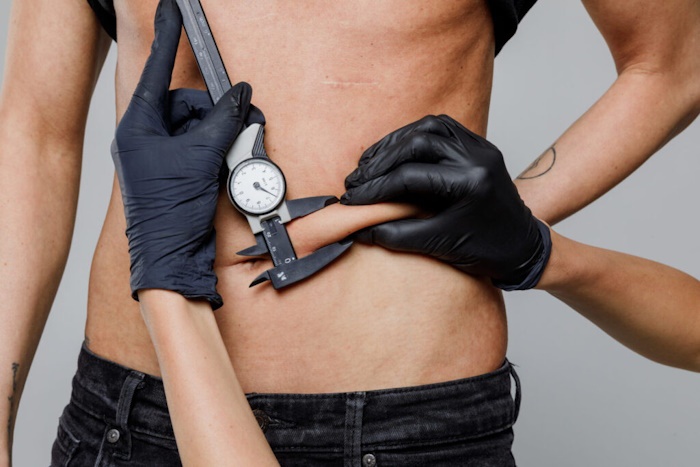 Липосакция для мужчин